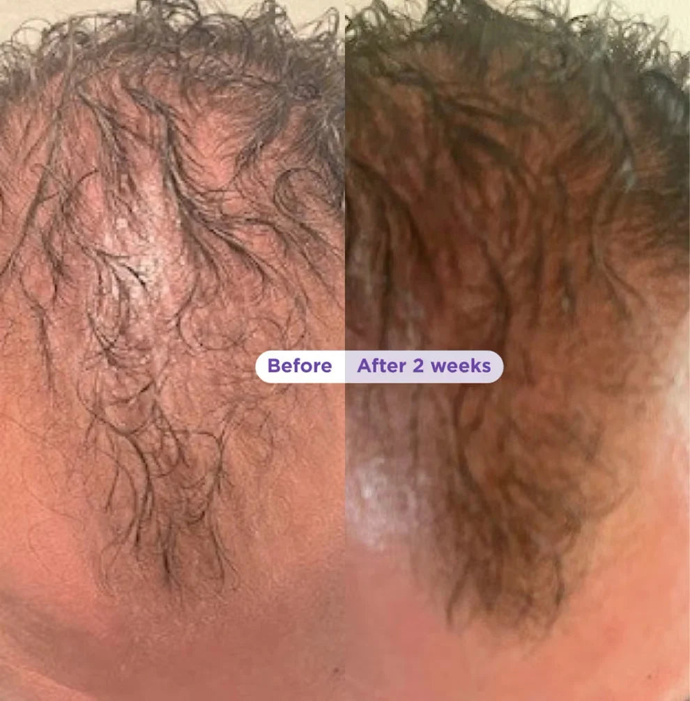 Pavria Biotin &amp; Rosemary Thickening Shampoo &amp; Conditioner Set
